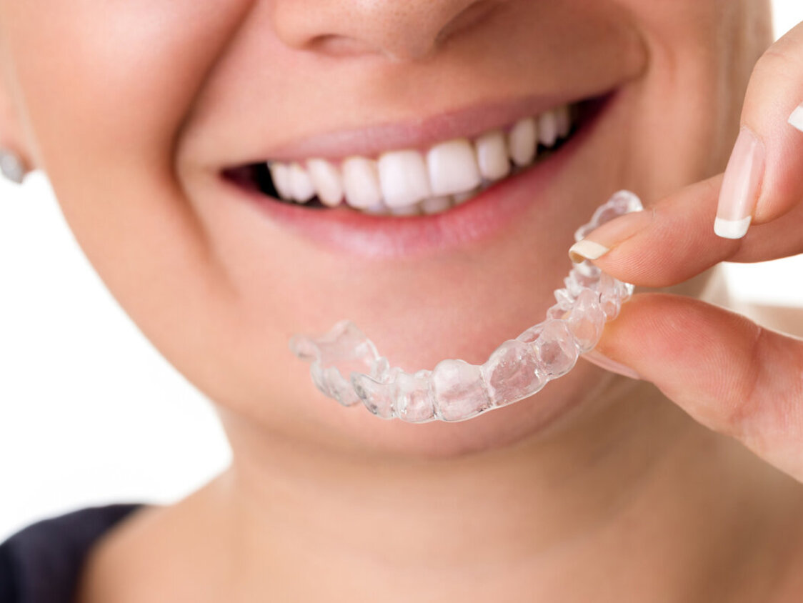 Woman,With,Perfect,Teeth,Holding,Invisible,Braces,,Correction,Teeth,Braces