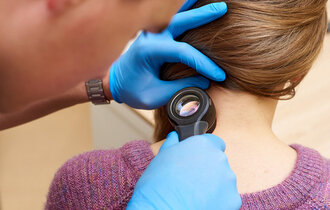 A,Safe,Way,To,Diagnose,Skin,Diseases.,Examination,Of,Moles