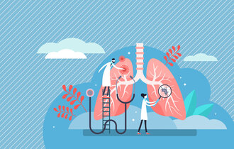 Grafik mit Lunge