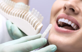 Comparison,Of,The,Female,Patient,Teeth,With,The,Dental,Whitening