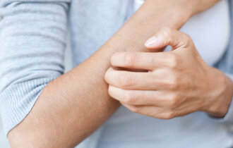 Woman scratching her arm